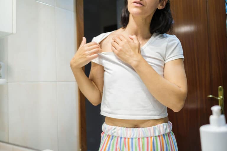 What’s the link between psoriasis severity and psoriatic arthritis