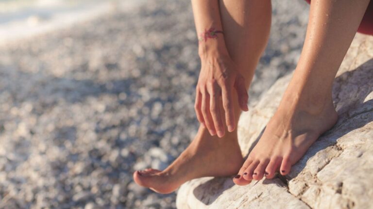 How to cover psoriasis flares on the legs