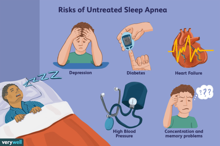 Sleep Apnea